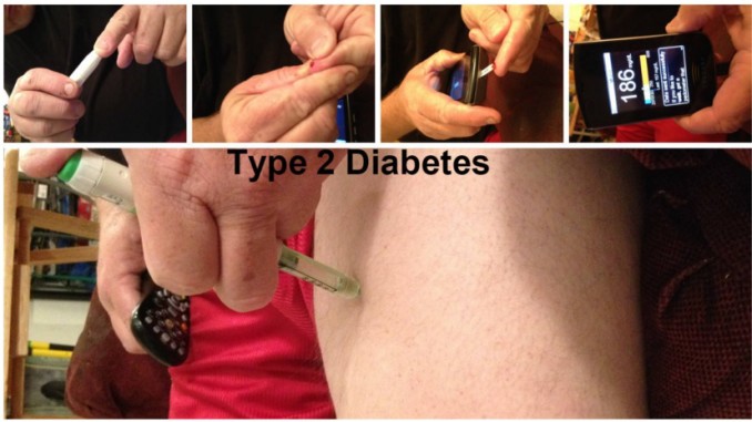 type 2 diabetes